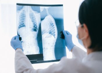 Asbestos-Related Lung Cancer vs. Mesothelioma: Key Differences
